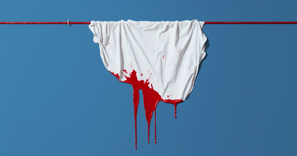 © History Oasis Bloodletting